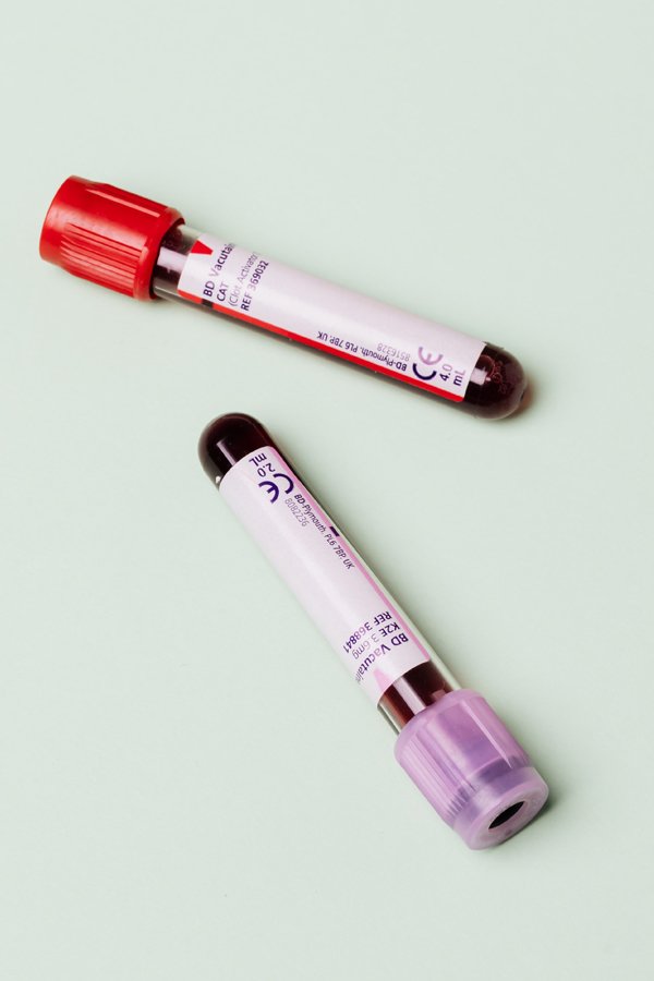 thyroid bernhoft ojai